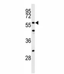 CDC25C Antibody - image 1