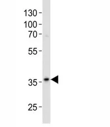 Anit-GAPDH Antibody - image 1