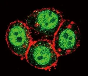 PAK1 Antibody - image 1