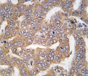 PAK4 Antibody - image 1