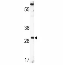 BDNF Antibody - image 1