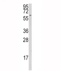 CYP1A1 Antibody - image 1
