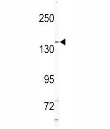 NIK Antibody (Nck-interacting kinase) - image 1