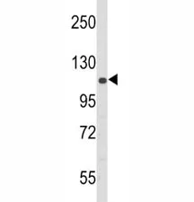 PERK Antibody - image 1