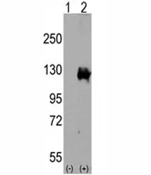 TRPM8 Antibody - image 1