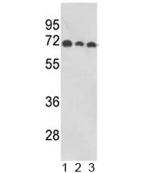 ABI1 Antibody / SSH3BP1 - image 1
