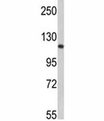 Retinoblastoma Antibody - image 1