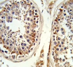 Integrin beta 3 Antibody - image 1