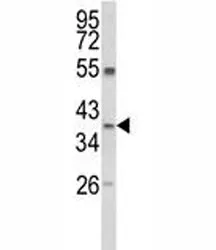Arginase 1 Antibody (ARG1) - image 1