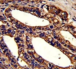 ORAI1 Antibody (CRACM1) - image 1
