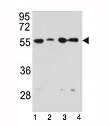 Vimentin Antibody - image 1