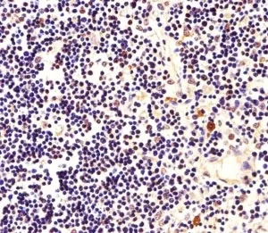 Nucleophosmin Antibody (Npm1) - image 1