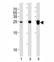 UCHL1 Antibody - image 1