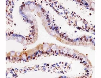 Cdk4 Antibody - image 1