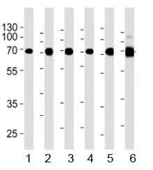 Acetylcholinesterase Antibody / ACHE - image 1