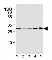 CDK5 Antibody - image 1