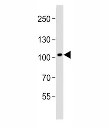 DDR1 Antibody - image 1