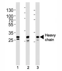 Cathepsin D Antibody (heavy chain) - image 1