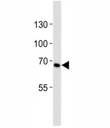 CD30 Antibody - image 1