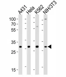 CDK5 Antibody - image 1
