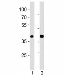 PDX1 Antibody - image 1