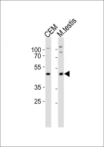 Lhx1 Antibody - image 1