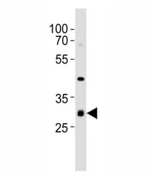 CDK5 Antibody - image 1