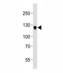 DDR1 Antibody - image 1