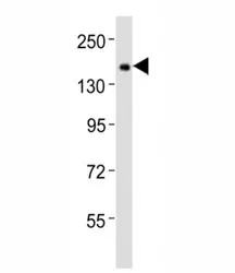 Tet1 Antibody - image 1