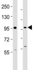 EZH2 Antibody - image 1