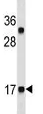 CGRP Antibody (CALCA) - image 1