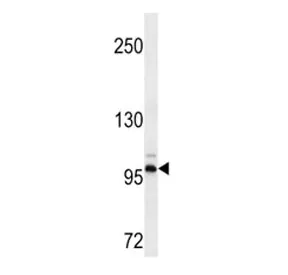 DDR2 Antibody - image 1