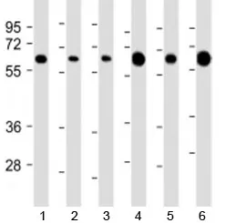 PGM1 Antibody / Phosphoglucomutase 1 - image 1
