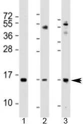 Phospholipase A2 Antibody / PLA2G2A / sPLA2 - image 1