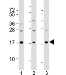 Phospholipase A2 Antibody / PLA2G2A / sPLA2 - image 1