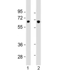 SLC5A8 Antibody / Sodium-coupled monocarboxylate transporter 1 - image 1
