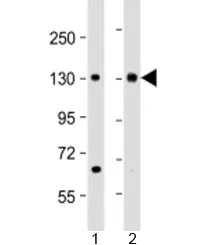 MTUS1 Antibody / Microtubule-associated tumor suppressor 1 - image 1