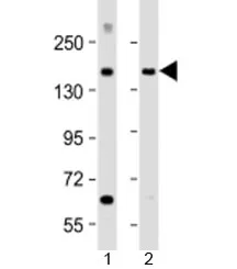 MTUS1 Antibody / Microtubule-associated tumor suppressor 1 - image 1