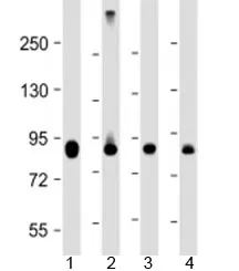 PFKP Antibody / Phosphofructokinase platelet - image 1