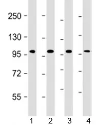 TPX2 Antibody / Targeting protein for Xklp2 - image 1