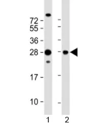 PIMT Antibody / PCMT1 - image 1