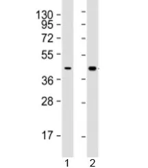 AGXT Antibody - image 1