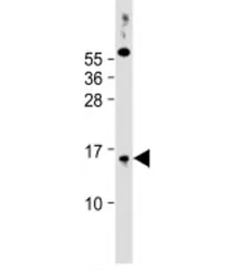 SYNJ2BP Antibody / Synaptojanin-2-binding protein - image 1