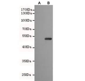 PPAR gamma Antibody / PPARG - image 1