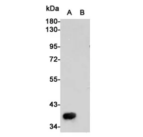 MET Antibody / c-Met / HGFR - image 1
