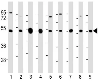 Tubulin beta 2A Antibody / TUBB2A - image 1