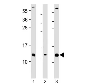 CKS2 Antibody / Cyclin-dependent kinases regulatory subunit 2 (N-Terminal Region) - image 1