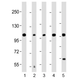 KCNH1 Antibody (C-Terminal Region) - image 1