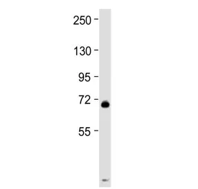 Thrombopoietin Receptor / c-MPL / MPL Antibody (C-Terminal Region) - image 1