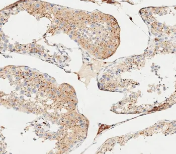 CTSA Antibody / Cathepsin A - image 1